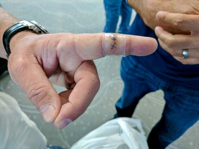Not a good look before a golf trip.